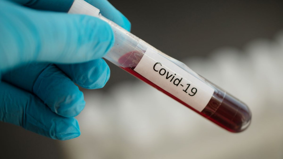 Ситуация с коронавирусом: 13 738 новых случаев за сутки