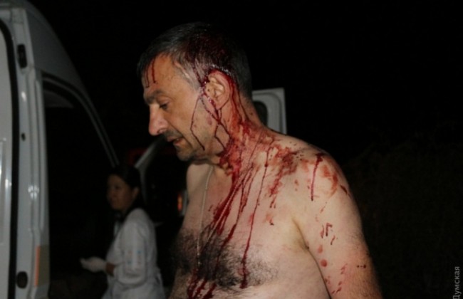 В Одесской области избили журналиста