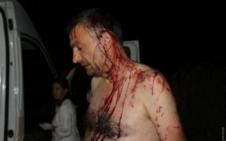 В Одесской области избили журналиста
