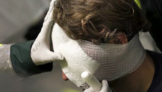 Лужа крови и тяжелое состояние: неизвестные проломили голову молодому киевлянину