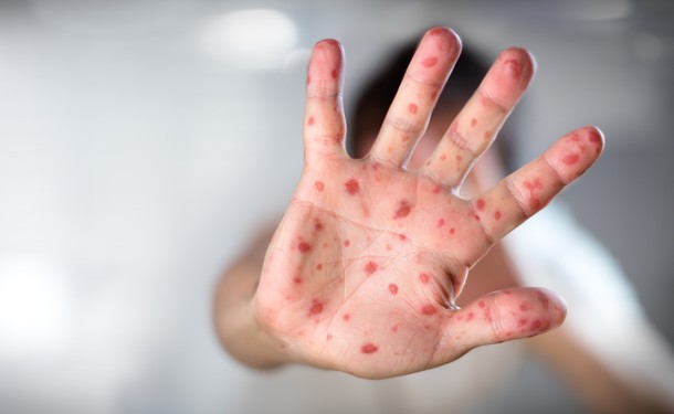 Киевские школы закрываются на карантин