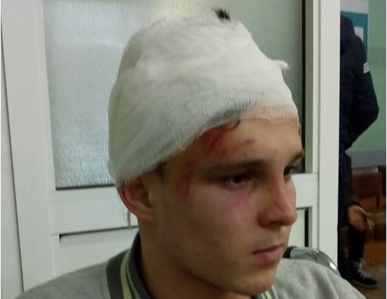 В новогоднюю ночь отморозки жестоко избили сына чиновницы