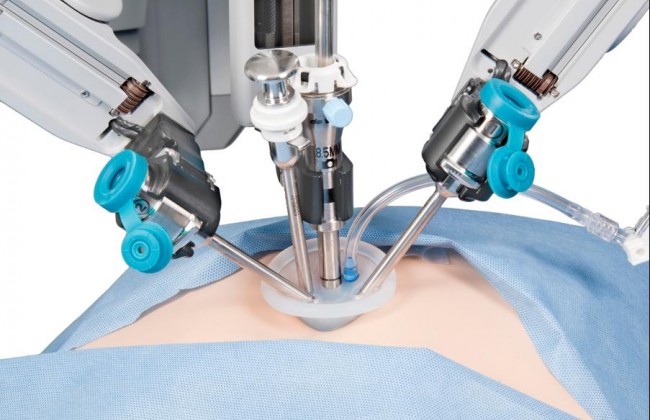 В Китае робот прооперировал человека (фото)