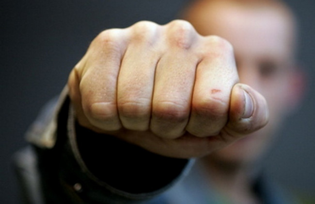 В Буковеле жестоко избили сына депутата, опубликованы фото