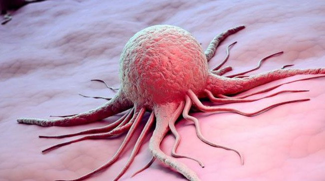 Медики назвали продукты-убийцы рака