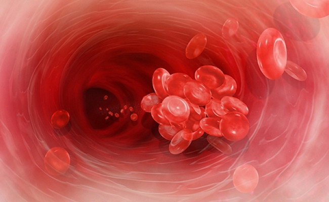 Эти четыре продукта эффективно разжижают кровь