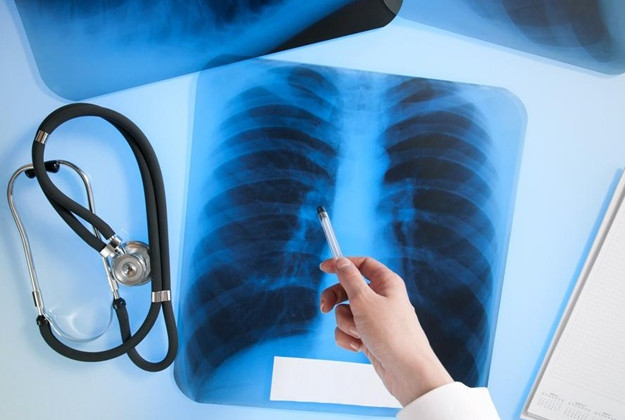 Украинцам объяснили, можно ли подхватить туберкулез в маршрутке