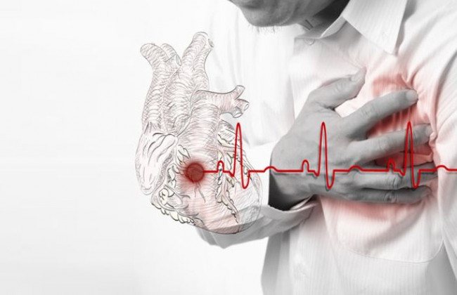 Главные причины инфарктов и инсультов: медики объяснили