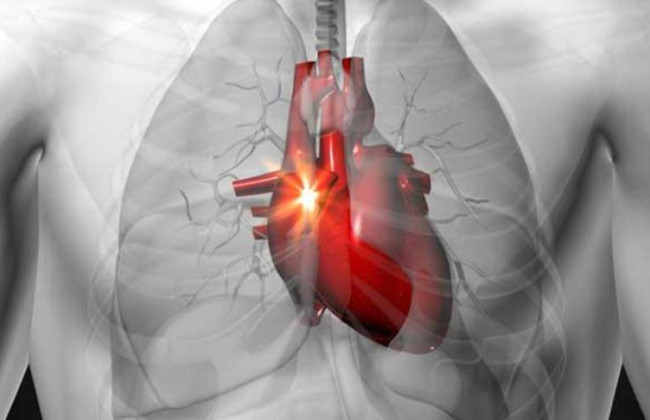 Сильное сердцебиение: что следует знать и как уберечься