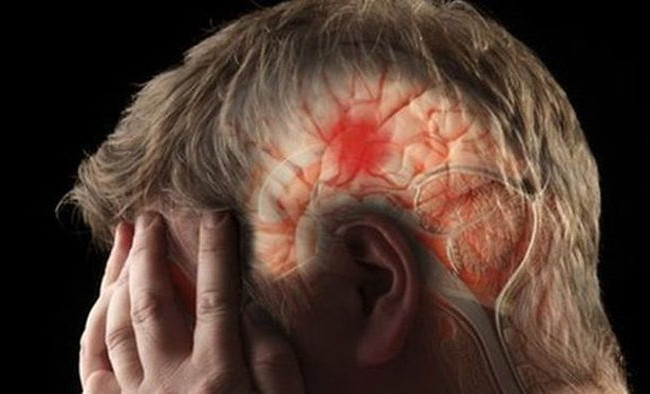 Опасный инсульт: как вовремя распознать приближение болезни