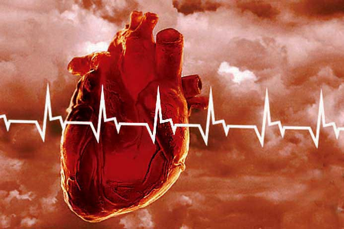 Как избежать инфаркта: названы эффективные способы