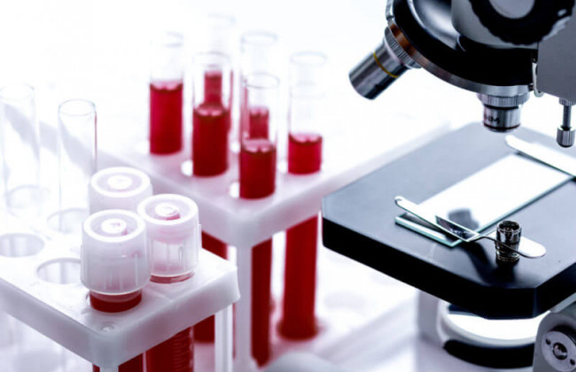 Названа еще одна причина риска ранней смерти