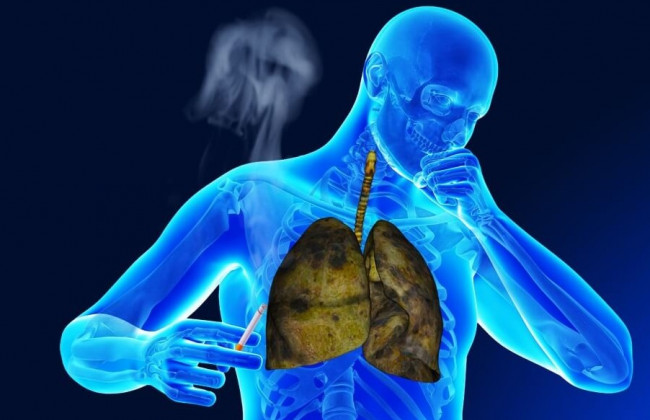 Назвали простой способ очистить легкие за три дня