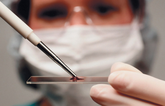 Эти два продукта провоцируют появление шести видов рака