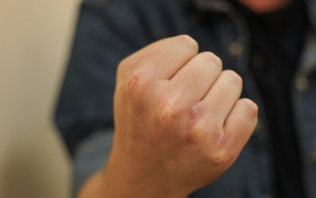 Избивали и грабили: в Одессе трое парней ночью нападали на прохожих