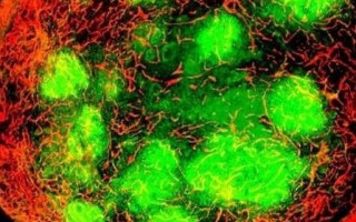 Что провоцирует развитие рака молочной железы: медики объяснили