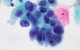 Этот продукт провоцирует появление семи различных видов рака