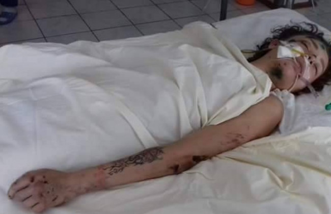 Жуткое ДТП под Киевом: неопознанная девушка лежит в реанимации