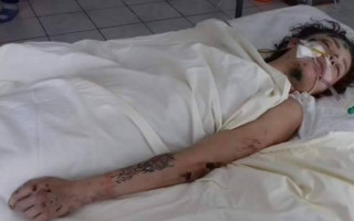 Жуткое ДТП под Киевом: неопознанная девушка лежит в реанимации