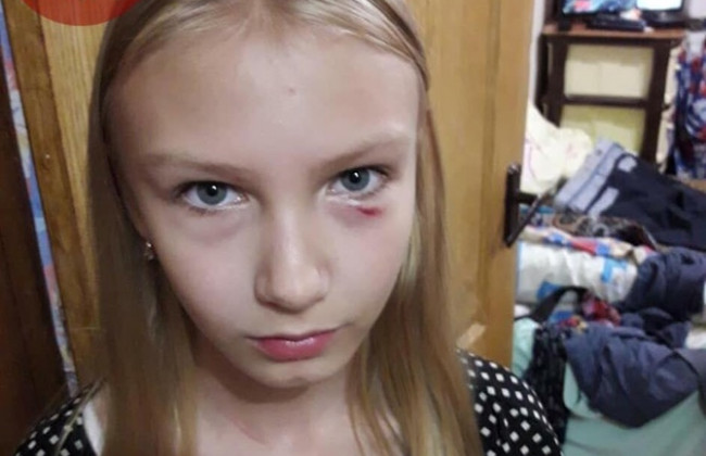 В Киеве пожилая женщина напала на 11-летнюю девочку и ее отца