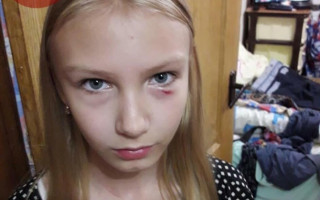 В Киеве пожилая женщина напала на 11-летнюю девочку и ее отца