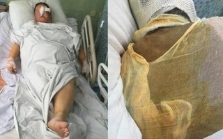 Четверо подозреваемых в покушении на Гандзюк признали вину