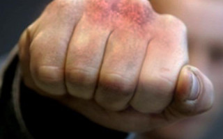 Избили водителя и кондуктора: дебоширы поставили «на уши» Херсон