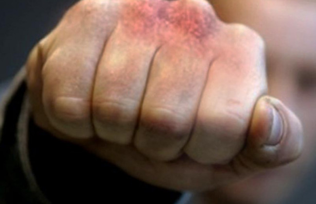 Избили водителя и кондуктора: дебоширы поставили «на уши» Херсон