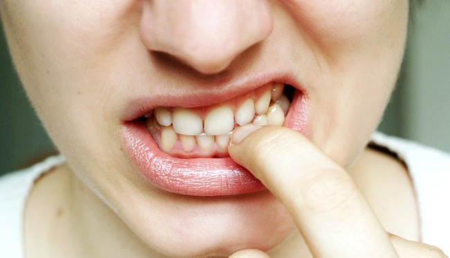 Девушка покусала патрульную в Чернигове