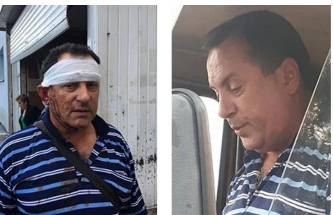 «Отказался перевозить детей»: появились подробности об избиении водителя маршрутки во Львове