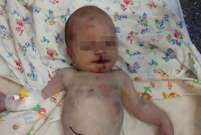 Подброшенный младенец умер в первомайской больнице