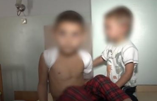 Под Херсоном отец избил детей до переломов и подался в бега