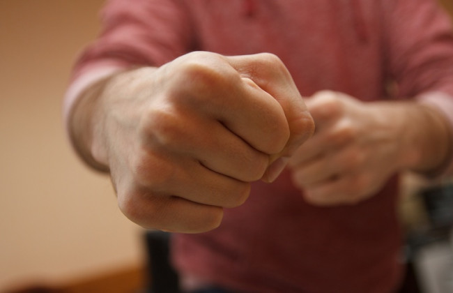 «Лицо прикрывали медицинскими масками»: под Киевом мужчину избили и подожгли