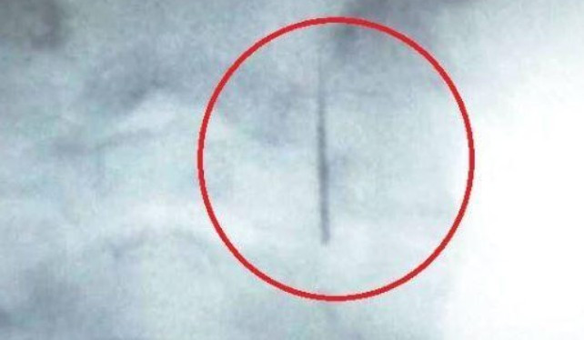 «Забув» голку у горлі дитини: з'явилися подробиці у скандальній справі