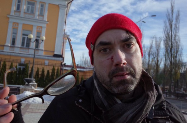 В Киеве напали на канадского журналиста: есть подробности