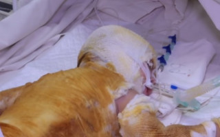 Каструлю з окропом перекинула на себе дитина на Дніпропетровщині