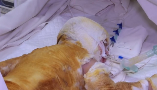 Каструлю з окропом перекинула на себе дитина на Дніпропетровщині