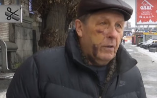 Побиття авіаконструктора ДП «Антонов»: прокуратура розшукує поліцейських