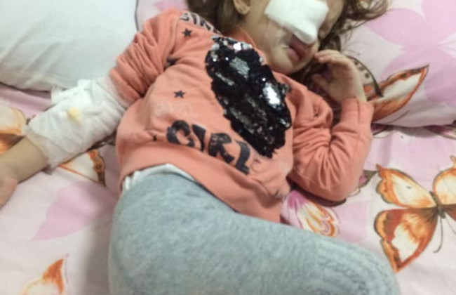 ЧП в детском саду Днепра: ребенку карандашом прокололи глаза