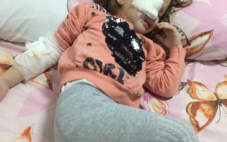 ЧП в детском саду Днепра: ребенку карандашом прокололи глаза