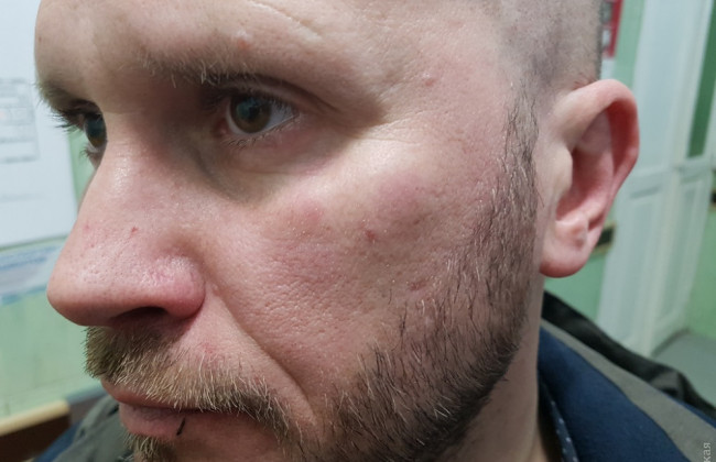 «Я буду тебя убивать и кончать»: в Одессе напали на журналиста