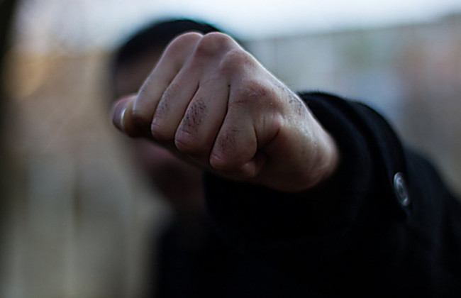 Скандал у лікарні Закарпаття: від побоїв помер 68-річний чоловік