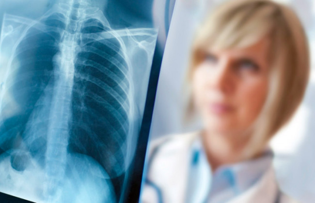 Киевлян приглашают бесплатно проверить легкие: список адресов