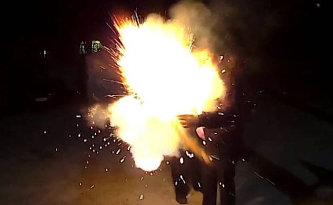 Взорвалась в руках: на Буковине мужчина получил рваную рану лица от петарды