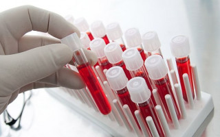 Безкоштовний тест на рак: коли в Україні можна буде перевіритись