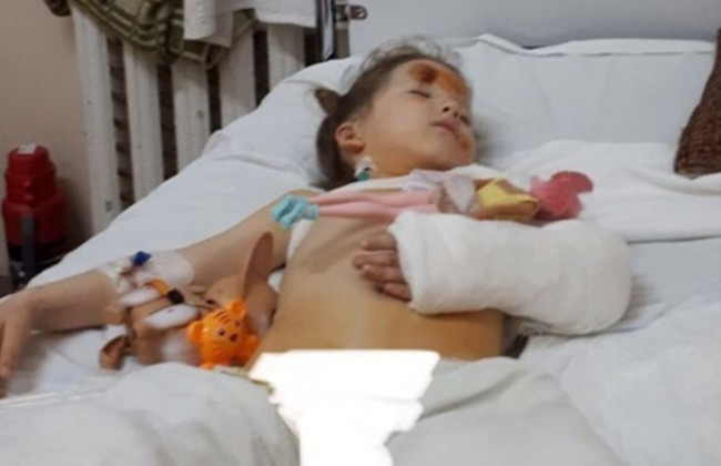 Рвані рани і багато переломів: стали відомі подробиці ДТП із донькою екс-АТОвця