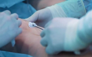 Скандал в Киеве: после липосакции в частной клинике умерла женщина