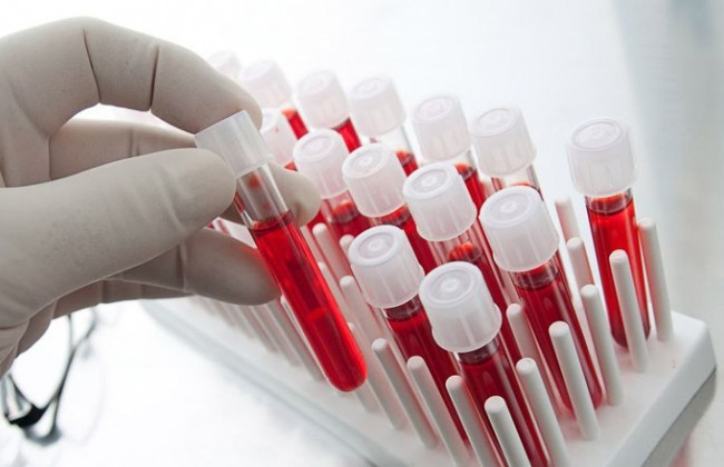 В Украине ввели новую методику лечения самой опасной болезни