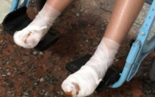 Под Киевом на аттракционе серьезно пострадал ребенок, есть фото