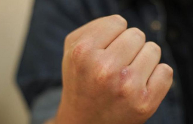 Бил камнем по голове: в Днепре мужчина напал на кондуктора трамвая